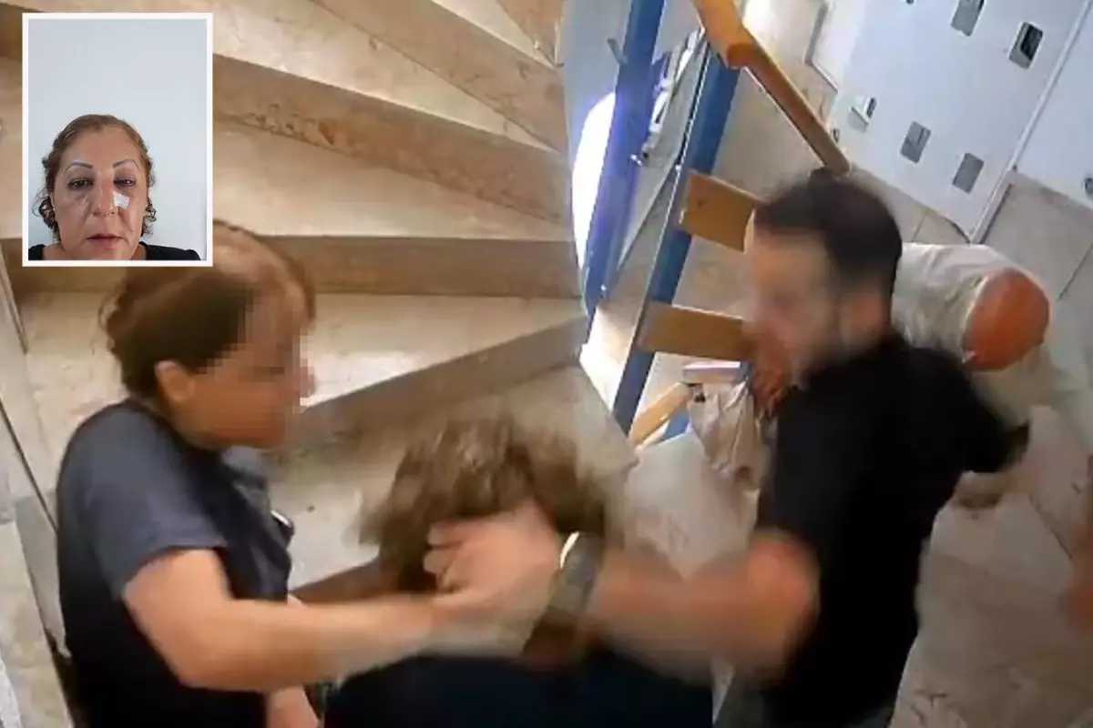 Kedi besleme kavgasında komşusunun burnunu kırdı Kedi besleme kavgasında komşusunun burnunu kırdı