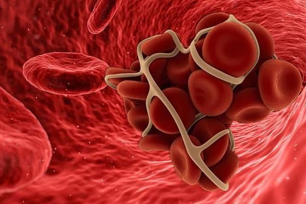 SAĞLIK Obezite ve sigara kullanımı tromboz riskini artırıyor