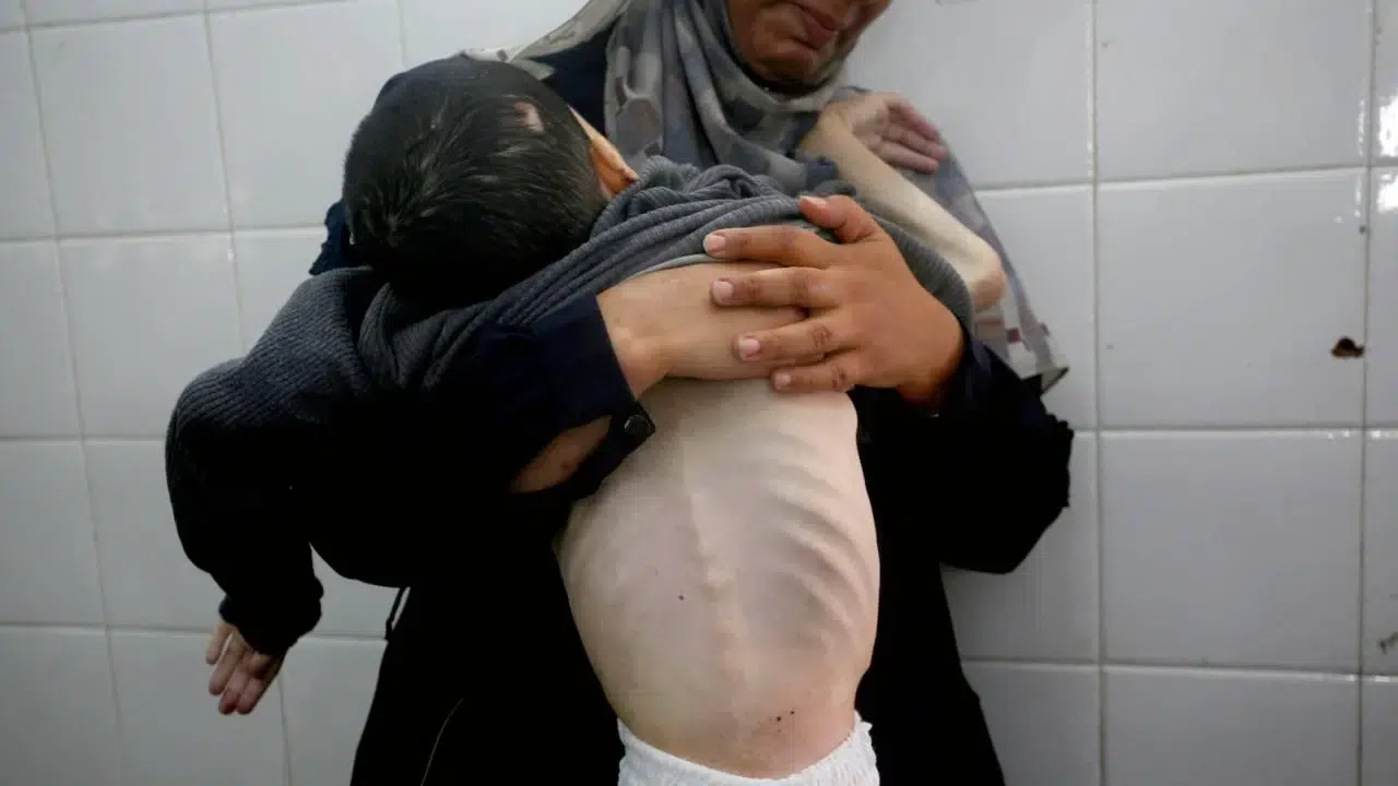 Gazze’de 453 Kişi Açlıktan Şehit Oldu