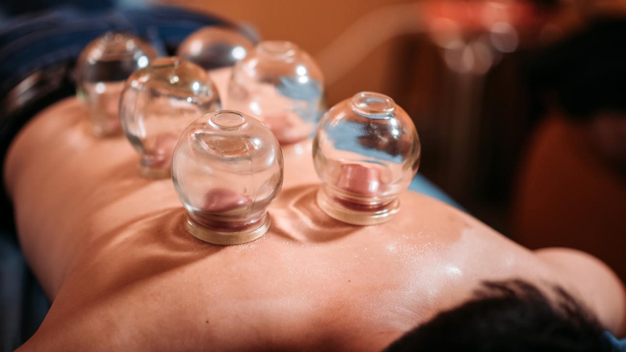 Kupa Tedavisi: Geleneksel Uygulamanın Sağlık Üzerindeki