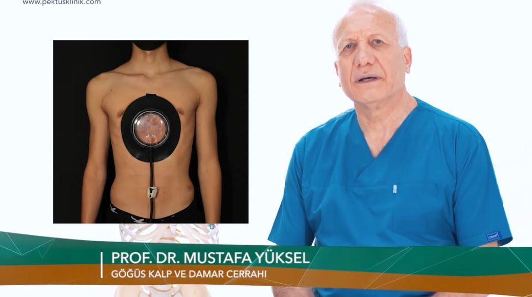 Pektus Hastalığı İçin Devlet Desteği Yetersiz Kalıyor